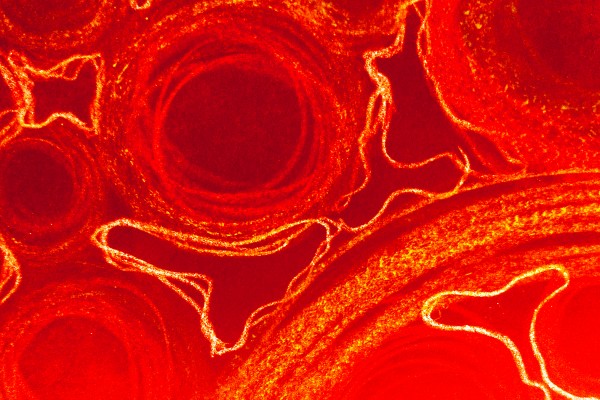 bigstock-Cancer-Cells-Transparent-Bloo-378033100